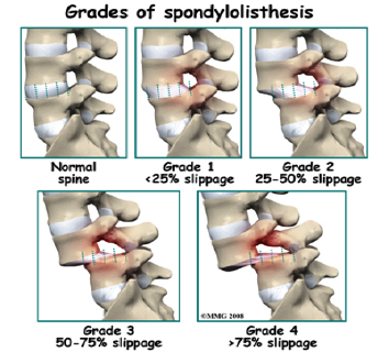 Lakeside Chiropractic Perth Joondalup Chiropractic Care